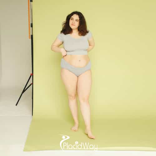 Post-Weight Loss Restoration: Why 2026 Seoul Lipo Trends Focus on Skin Retraction Over Fat Removal